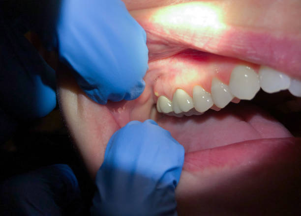 Emergency Orthodontic Repairs